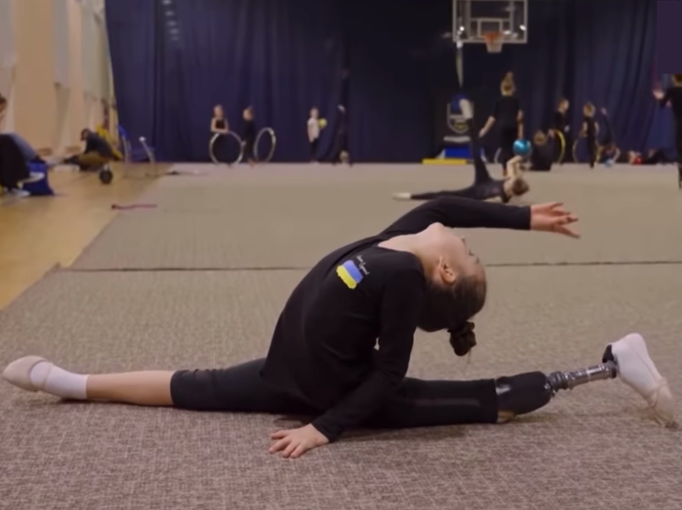 Враг искалечил, но не сломал. Как сегодня живет 7-летняя гимнастка с протезом Саша Паскаль: сильные фото